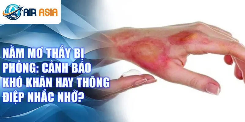 Nằm mơ thấy bị phỏng: cảnh báo khó khăn hay thông điệp nhắc nhở?