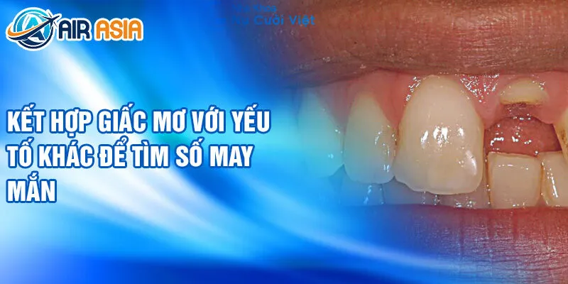 Nằm Mơ Thấy Răng Gãy: Bí Ẩn Và Ý Nghĩa Sâu Xa 3 Kết hợp giấc mơ với yếu tố khác để tìm số may mắn